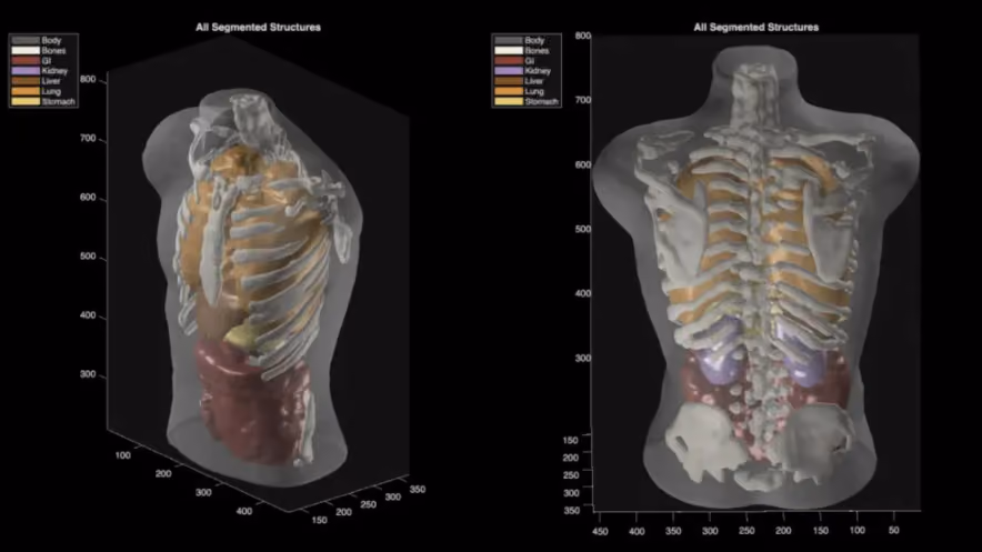 Deux rendus 3D d’un torse humain translucide laissant voir le squelette et les organes colorés, os, poumons, foie, reins et tube digestif, sous le titre « All Segmented Structures ».
