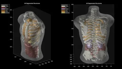 Deux rendus 3D d’un torse humain translucide laissant voir le squelette et les organes colorés, os, poumons, foie, reins et tube digestif, sous le titre « All Segmented Structures ».
